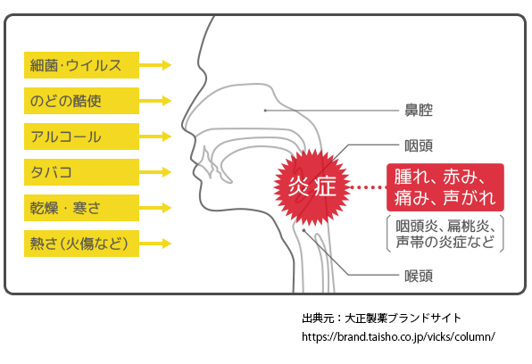 のどの痛み